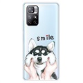 IMD Xiaomi Redmi Note 11 Pro/Note 11 Pro+ TPU Cover - Smile