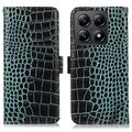 Xiaomi 14T Pro Crocodile Series Læderpung med RFID